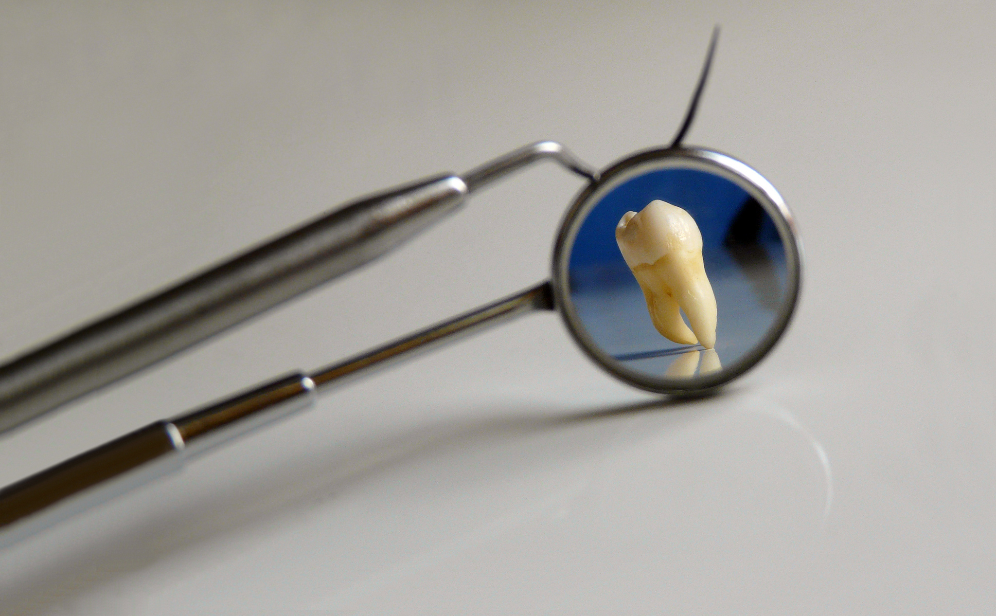 Crucial Facts about Wisdom Teeth